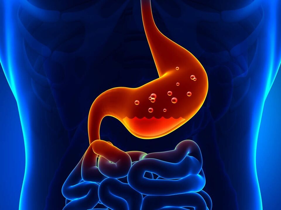 Gastritis is an inflammatory disease of the stomach that requires a diet